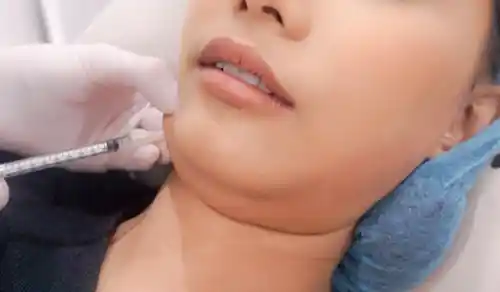 เมโสแฟต 06
