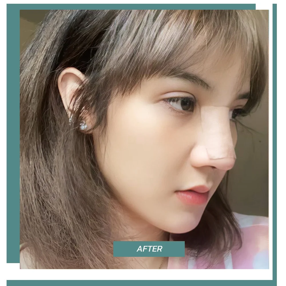 ผลลัพธ์หลังทำ 03