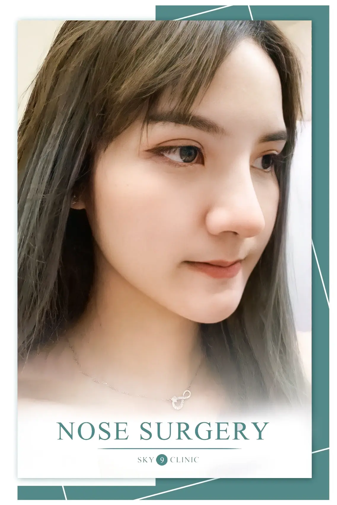 ผลลัพธ์หลังทำ 02
