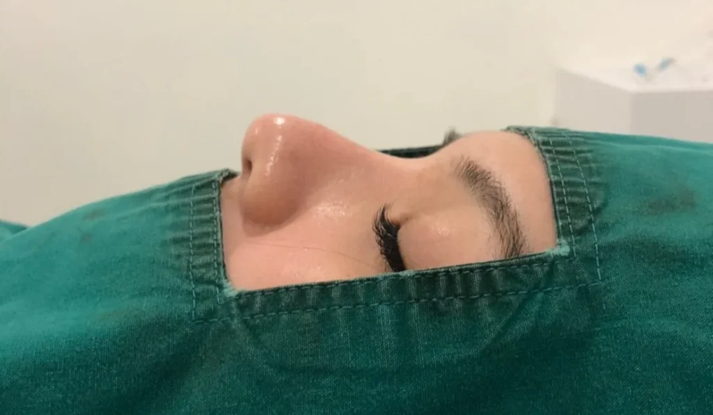 ผลลัพธ์หลังทำ 01