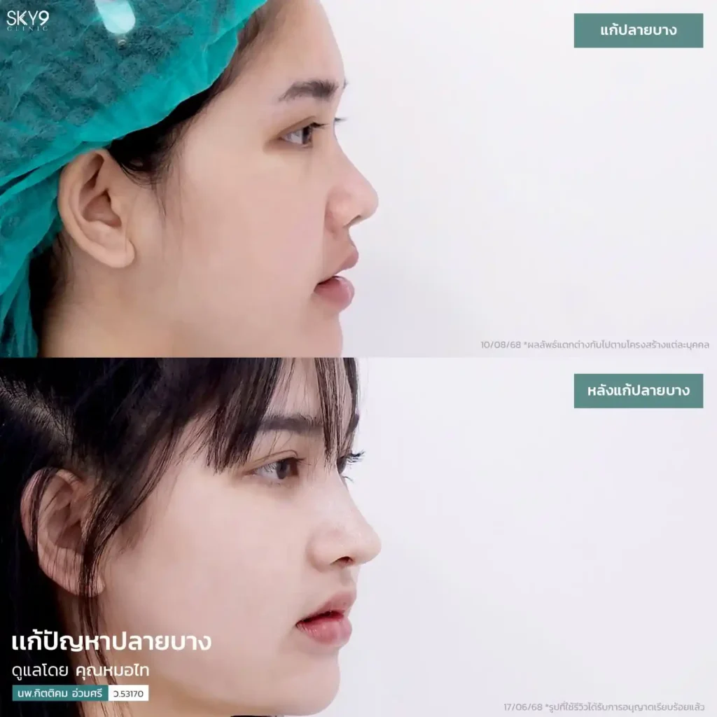 รีวิว 02