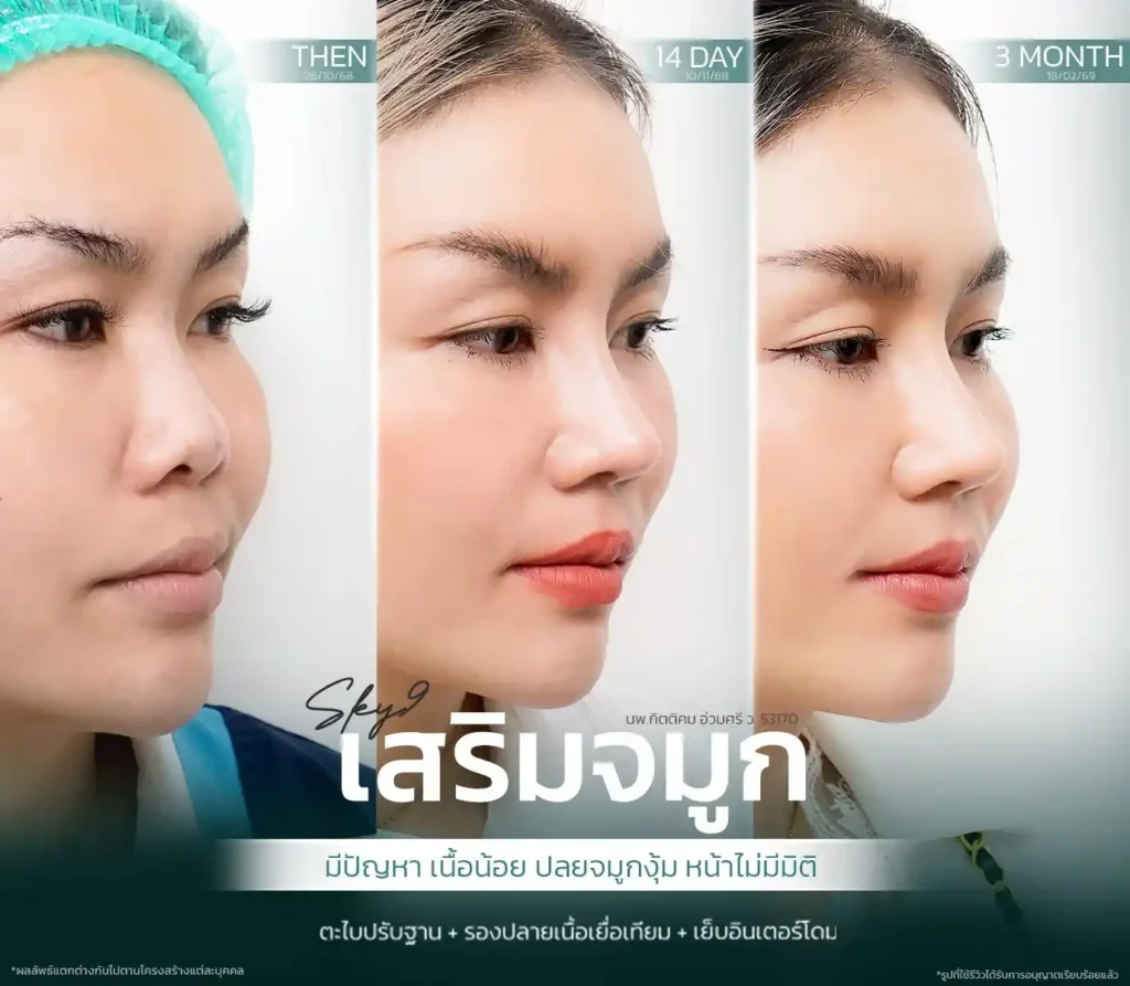 รีวิว 07