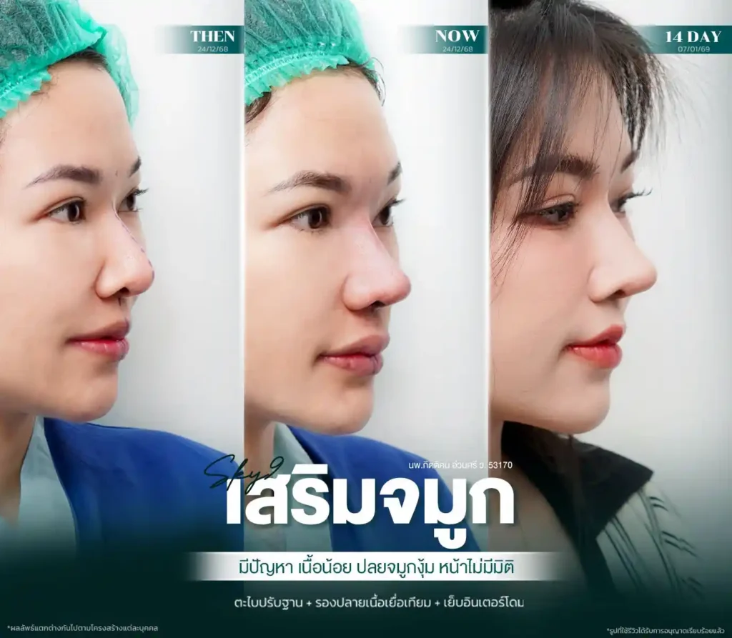 รีวิว 08