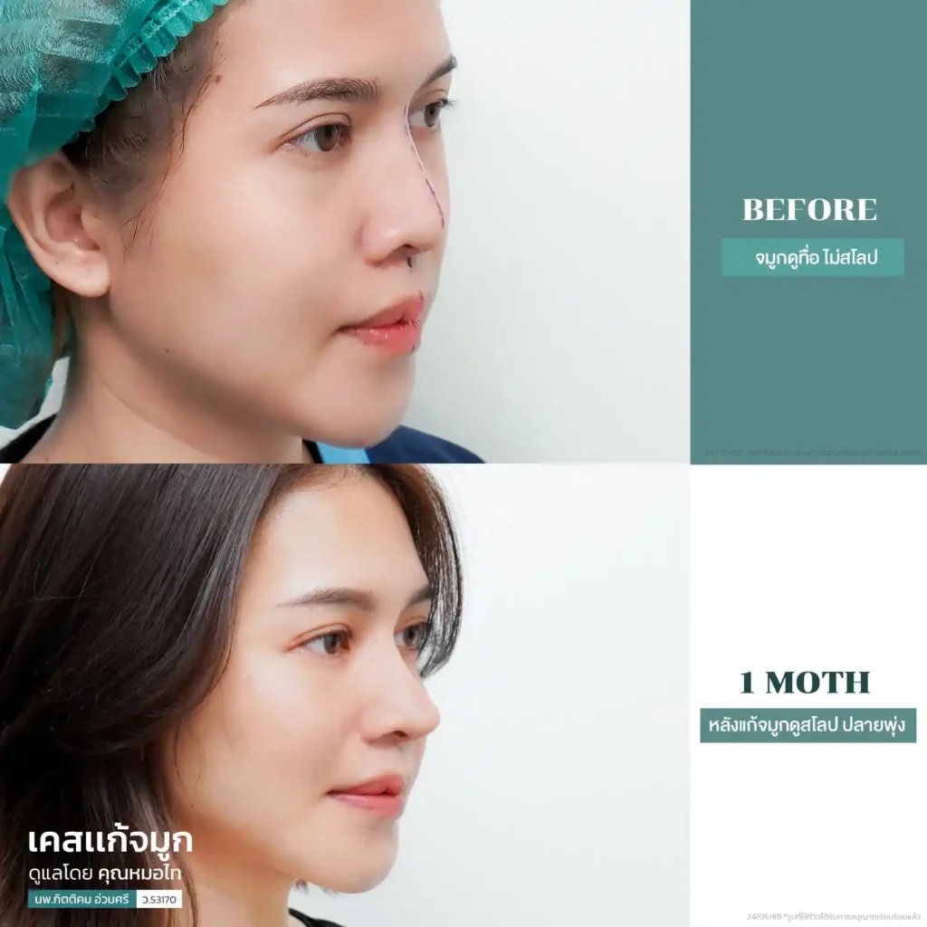 รีวิว 13