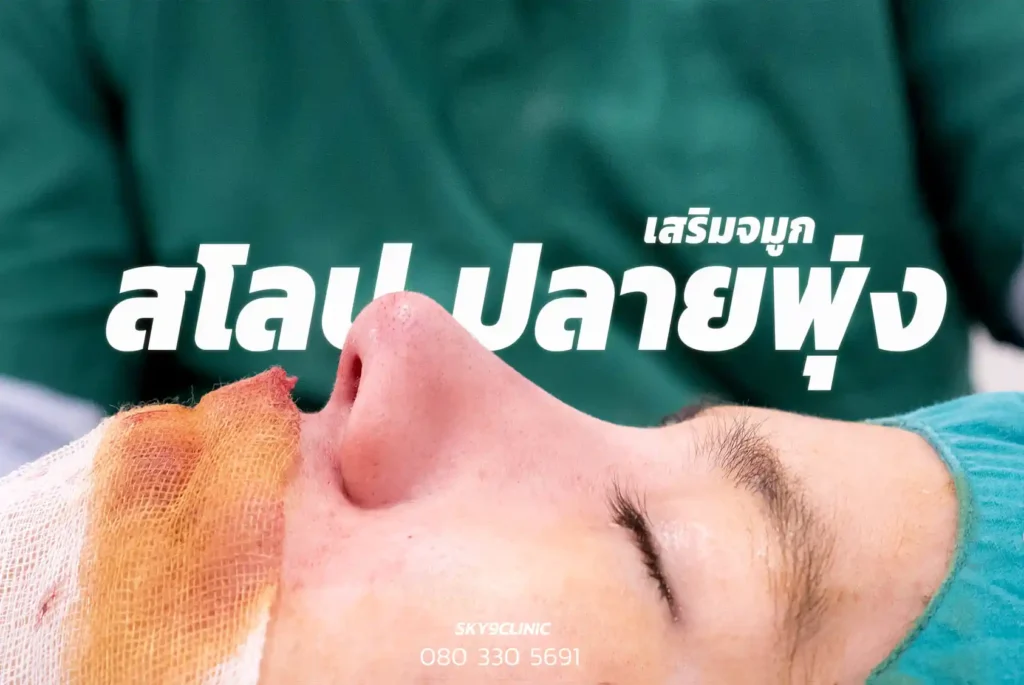 รีวิวเสริมจมูก 10