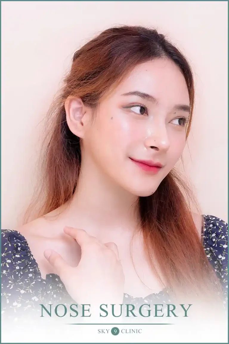 รีวิวเสริมจมูก 11